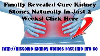 Kidney Stones Symptoms, What Causes Kidney Stones, Stone In Kidney, Struvite Stones