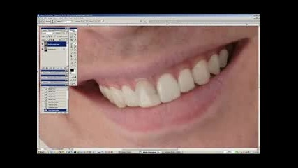 Избелване На Зъби С Photoshop