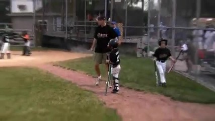 Момче играе бейзбол само с един крак!