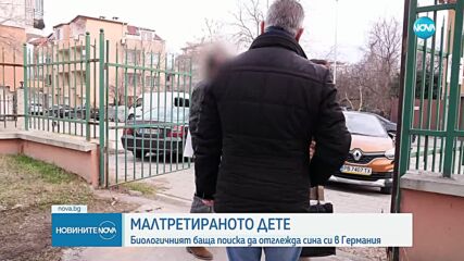 Обезобразеното 5-годишно момченце от Пловдив беше оперирано