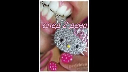 Sweet poison - - - epzz.. 2 :) 