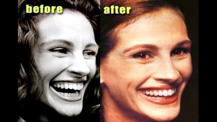 Известните личности преди и след пластичните операции