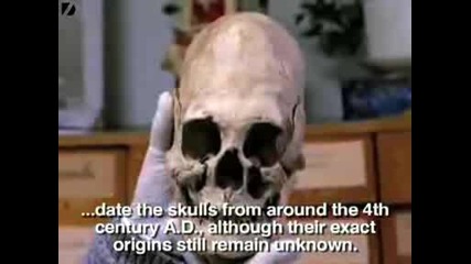 Strange Elongated Skulls Discovered