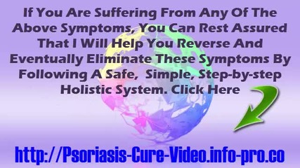 Psoriasis Vulgaris, Psoriasis On The Scalp, Can Psoriasis Be Cured, Vitamin D And Psoriasis