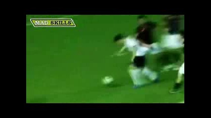 Mad Skills Part 4