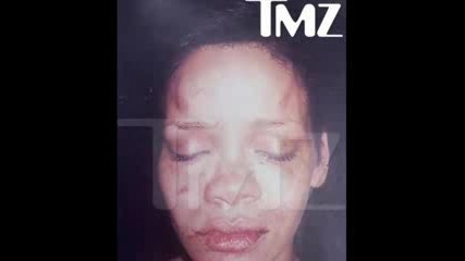 Шокираща Снимка На Rihanna След Инцидента С Chris Brown! 