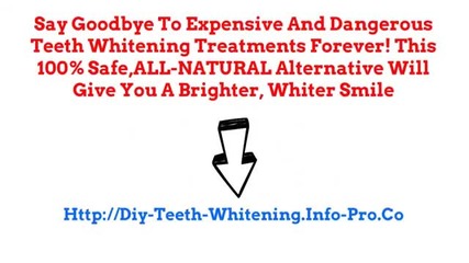 Natural Teeth Whitening, Cheap Teeth Whitening, Uv Teeth Whitening, Teeth Whitening Pen Reviews