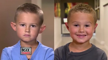 Родители разрешават на 6 г. момче да си направи пластична операция на ушите