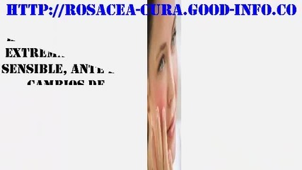 Remedios Caseros Para La Rosacea, Enfermedad De La Piel Rosacea, Rosacea Cura