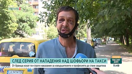 „Пребиха ме за една енергийна напитка“: Таксиметров шофьор разказва за побой срещу него