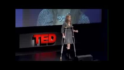 Allison Hunt How I got my new hip 