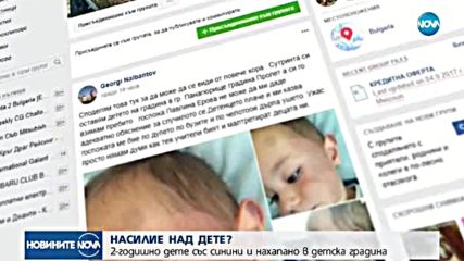 БОЙ В ДЕТСКА ГРАДИНА?: Родител взе детето си със синини