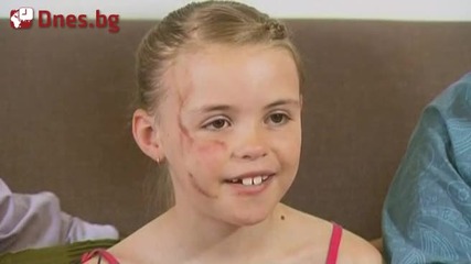 Кенгуру нападна 7-годишно момиченце