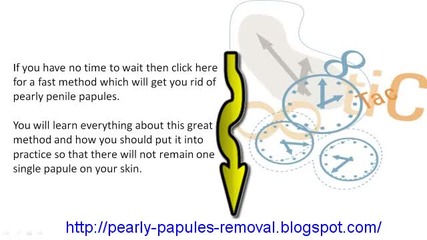 Can Castor Oil Treat Pearly Penile Papules 