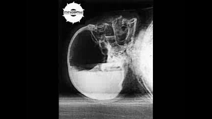 Zardonic - Embalmer