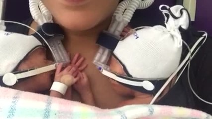 Недоносени близнаци се хванаха за ръка в обятията на майка си (ВИДЕО)