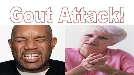 Signs And Symptoms Of Gout