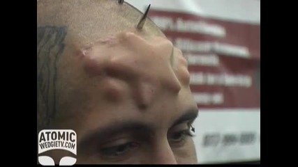 World of Weird - Skull Implants