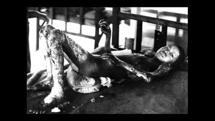 Gary Moore - Hiroshima