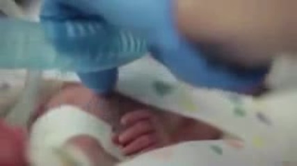 Първата година на бебе, родено 3,5 месеца преждевременно