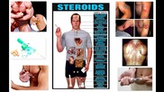 Muscle Damage - Страничните ефекти от анаболните стероиди част1