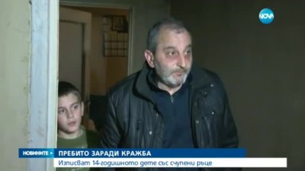Изписаха от болница детето, на което му счупиха ръцете заради кражби