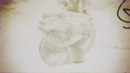 Heartist - Heart Of Gold