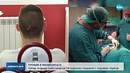 Лекар създаде ново лице на младеж с огромен тумор