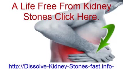 Signs Of Kidney Stones, Kidney Stones In Women, Herbs For Kidney Stones, Kidney Pain Causes