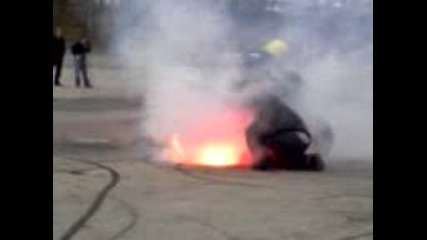 burn limoges