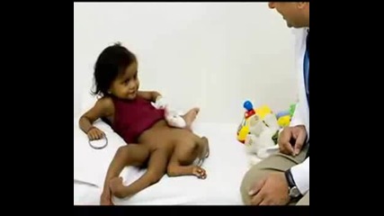 Lakshmi Tatma 8 limbed Indian girl