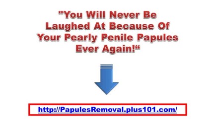 Treatment For Papules Review Treatment For Papules