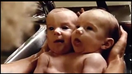 Близнаци, които споделят едно тяло - необикновени хора