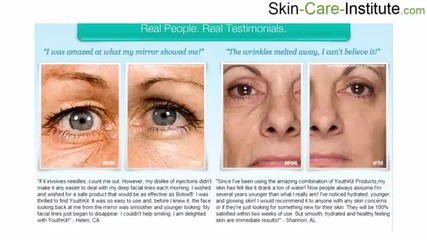 Youthkit Eye Cream Review - The Truth Of Using Youthkit Eye Cream