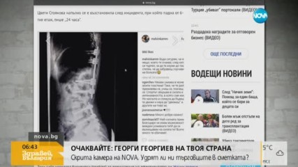 Гръбнакът на Цвети Стоянова прикрепен с пластини