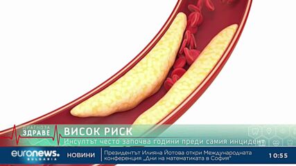 „Диагноза: Здраве“, еп. 77: Витамин D – колко ни е необходим и как да предпазим мозъка си