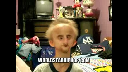 Progeria Rapper sings Eminem