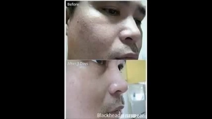 Jeuno Eumora Testimonial by Diana Ongko