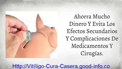 Vitiligo Causas, Vitilago, Fototerapia Vitiligo, Enfermedad De La Piel Vitiligo, Vitigilo