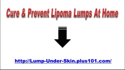 Natural Treatment For Lipomas In Humans