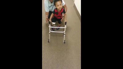 2 годишно дете прави първите си стъпки след поставяне на протеза на крака !