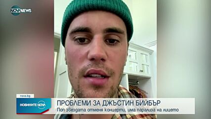 Джъстин Бийбър отменя концерти заради лицева парализа