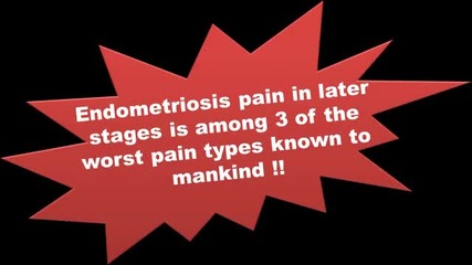 Uterus Alternative Treatment For Endometriosis