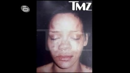 Btv - Истинска Снимка На Rihanna След Насилието Нанесено От Chris Brown!