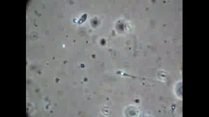 Вижте Сперма Под Микроскоп