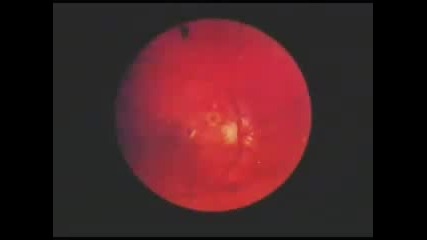 Secret Particle Weapons In Iraq 3 of 3