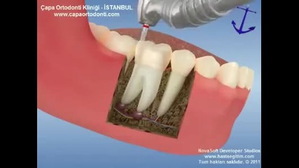 Вижте как се лекуват професионално зъби ;)