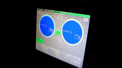 Uno Turbo no Dynamometro 