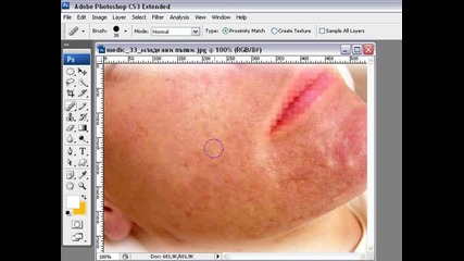 Премахване на пъпки с Photoshop