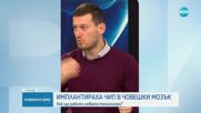 Революционна технология: Какво се очаква след успешното имплантиране на чип в мозъка на човек